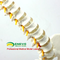 SPINE10 (12382) Quality Medical Science Anatomical Model ,Life-Size Vertebral Column with Pelvis